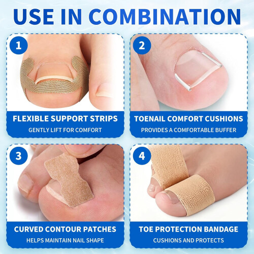 Ingrown Toenail Care Kit with Flexible Strips & Tools 2