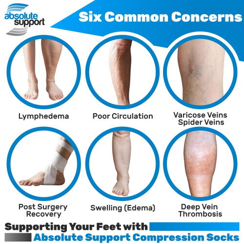 Collants de compression sans pieds ABSOLUTE SUPPORT 20-30 mmHg pour les gonflements, beige, taille moyenne 2