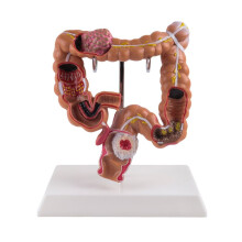 Teaching Model,Human Large Intestine Anatomy Model Visceral Lesion Model Human Digestive System Learning Model