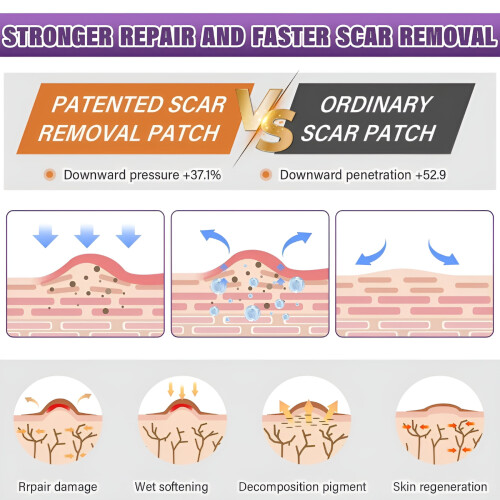 Silicone Scar Sheets Reusable Soft Breathable 2pcs 1