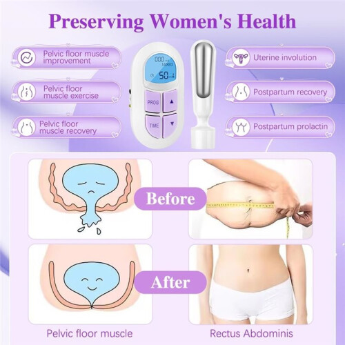 Incontinence Treatment Device, Pelvic Floor Exercise Devices