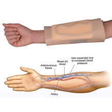 New Ultrassist Detachable IV Sleeve Trainer Kit for Forearm Phlebotomy Practice Split Venous Puncture Model