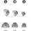 Resound Compatible Hearing Aid Domes Open Smokey Ear Tips Replacement 8mm (Medium 20pcs Pack) 3