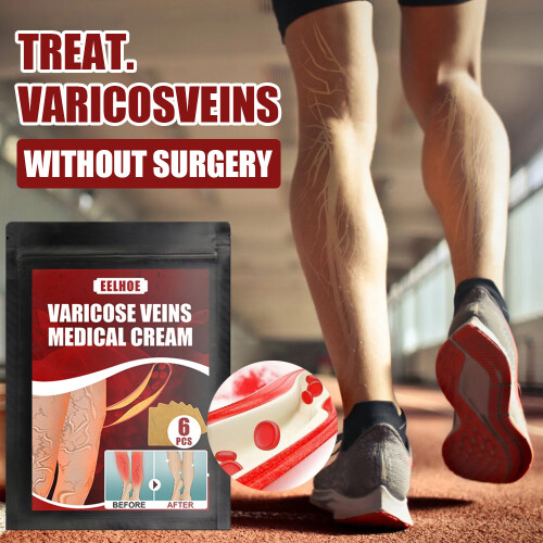 Varicose Veins Patch - Phlebitis & Vasculitis Relief