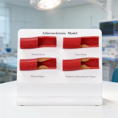 New Teaching Demonstration Model, Arterial Atherosclerosis Model, Vascular Model, Vascular Sclerosis Comparison Model 2