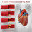 New Teaching Demonstration Model, Arterial Atherosclerosis Model, Vascular Model, Vascular Sclerosis Comparison Model 7