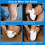 Prosthetic Calf Shrinker Protective Sock Silicone Compression Stocking S 5