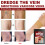 Varicose Veins Patch - Phlebitis & Vasculitis Relief 4