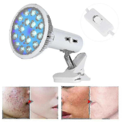 Λάμπα θεραπείας με μπλε φως (EU Plug) 18 τεμάχια τσιπ φωτός 460nm Αφαίρεση ουλών ακμής Λ 2