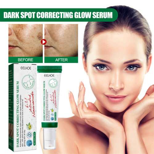2X Donkere Vlek Correctie -Glow Serum -50ml 2
