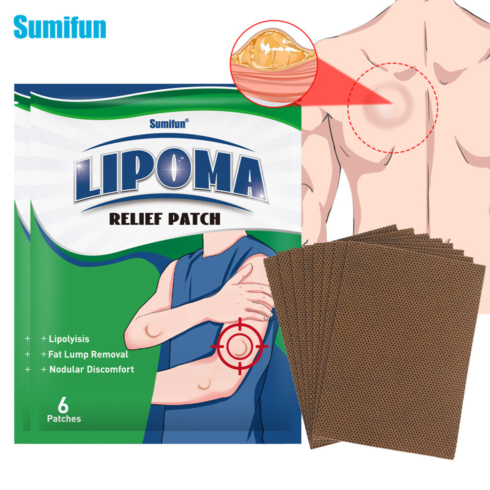 Hue-Grain 6Pcs Lipoma Removal Stickers, Body Pain Relief
