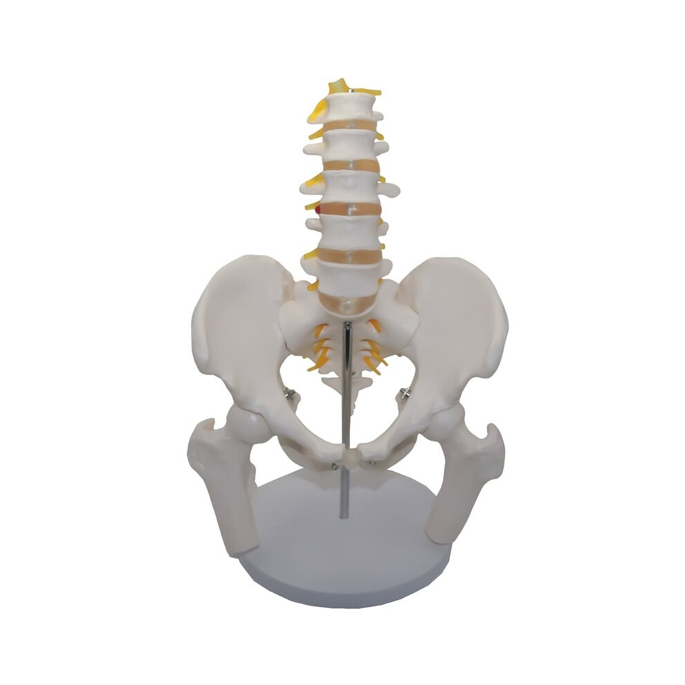 Tlily Umbar Vertebrae With Pelvic And Fractured Leg Bone Nerves Plastic Bone Model Of Human Body Teaching Equipment