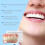Silicone Denture Set for Teeth Protection 2