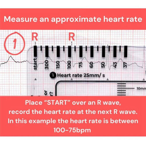 ECG 7 Step Ruler,ECG 7 Step Ruler for ECG/EKG Interpretation, ECG Reference Guide Ruler,EKG Calipers Measuring Tool 2