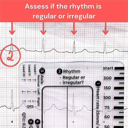 2pc ECG 7 Step Ruler,ECG 7 Step Ruler for ECG/EKG Interpretation, ECG Reference Guide Ruler,EKG Calipers Measuring Tool 2