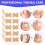 50pcs Ingrown Toenail Stickers - Pedicure Fixer Tool 2