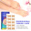 50pcs Ingrown Toenail Stickers - Pedicure Fixer Tool 4