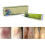 Anti-itch cream, herbal cream for allergic dermatitis 4