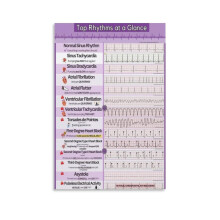 EKG och EKG-rytmer Canvas Poster Väggkonst För Rum Estetisk Och Dekor Poster För Sovrum Vardagsrum Badrum Kök Kontorsdekor