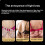 6Pcs Adjustable Bra Extender Clip Soft Elastic 3 Rows 2 Hooks Bra Extension Straps for More Support and Comfortable 4