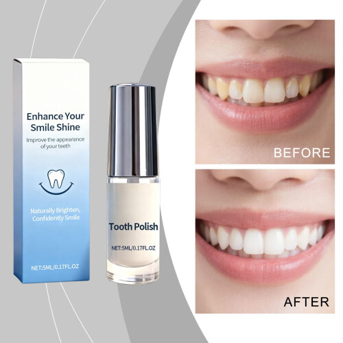 Tooth Polish Gentle Safe Formula Portable Teeth Whitening 1