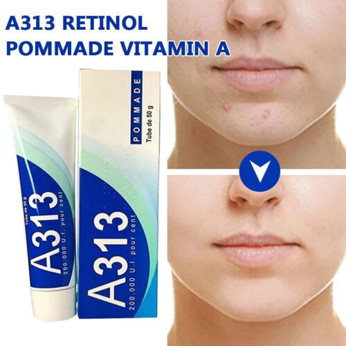 Pharma Développement - A313-vitamiini A-retinolivoide (50 g)