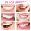 DIY-Zahnschmuck-Set LR41 4 eingebaut 10 ml Bling 9