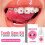DIY-Zahnschmuck-Set LR41 4 eingebaut 10 ml Bling 4