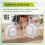 6Pcs Baseball Display Case,UV Protected Acrylic Display Box,Clear Display Case Memorabilia Autograph  Showcase 3
