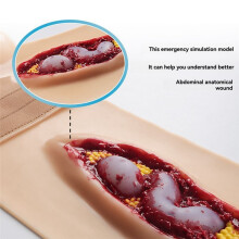 New Abdominal Anatomy Wound Training Model for Medical Teaching and Training, an Emergency Simulation Model Can Worn