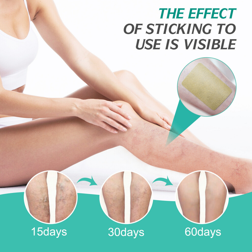 Creation-3C 8Pcs Varicose Vein Patch For Leg Treatment