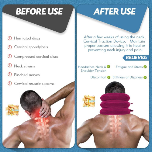 Dispositif de traction cervicale gonflable réglable 2