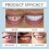 LONRYD Veneers Invisible Teeth Aligners Adjustable Snap-On Dentures for Quick Results 7