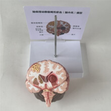 Human Brain Disease Model - Brain Pathology Brainstem Hemorrhage Medical Teaching Model - Human Brain Anatomy Model