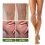 36pcs Varicose Vein Patch – Fat Burning, Anti-Inflammatory, Circulation 5