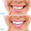 Braces Brush for Interdental Cleaning – 100 pcs, Light 7