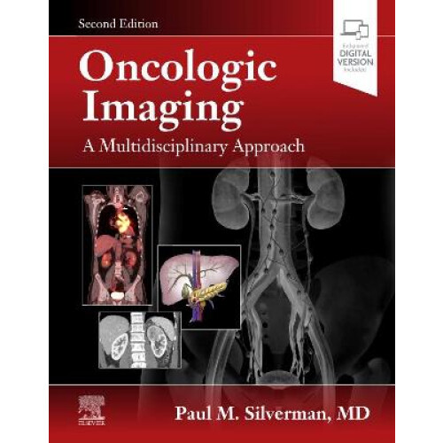 Oncologic Imaging: A Multidisciplinary Approach
