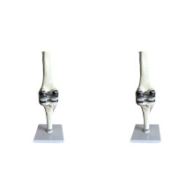 2X Knee Joint Model Simulation Replacement Surgery Meniscus Ligament Cartilages Surgery Model,Artificial Knee Joint