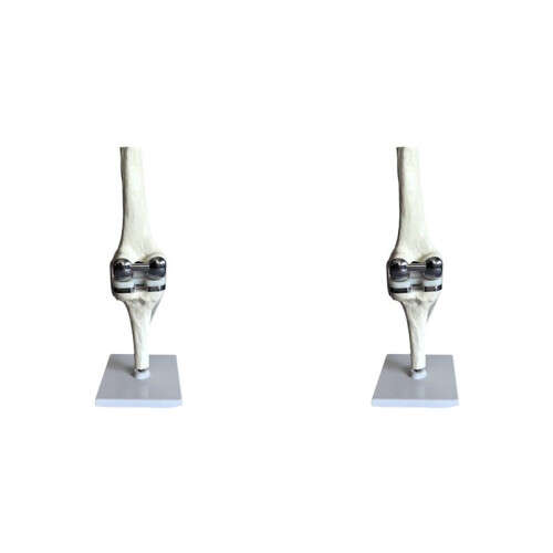 2X Knee Joint Model Simulation Replacement Surgery Meniscus Ligament Cartilages Surgery Model,Artificial Knee Joint