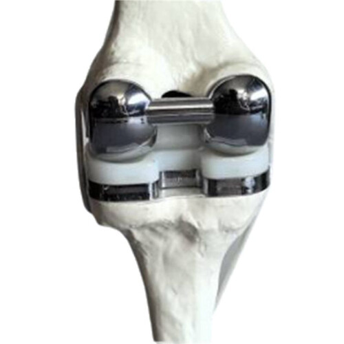 2X Knee Joint Model Simulation Replacement Surgery Meniscus Ligament Cartilages Surgery Model,Artificial Knee Joint