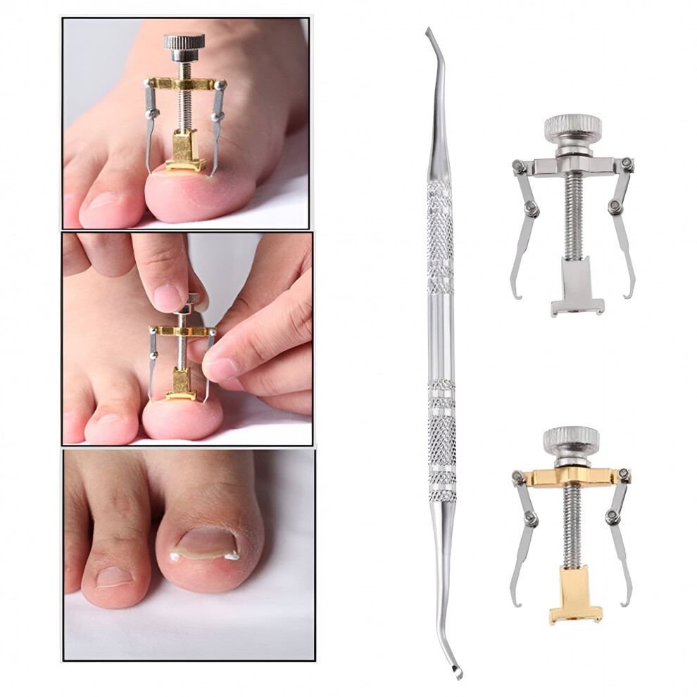 Paronychia Therapy Ingrown Toenail Lifter and Correction Tool Pedicure Treatment