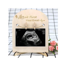 Wooden Ultrasound Picture Frame for Pregnancy Announcement – Compatible with Standard Sonogram Prints, Gender-Neutral Baby Shower Gift & Nursery