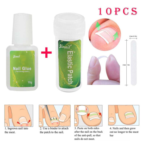 Foot Care Tool Ingrown Toenail Correction Patch Tool Set Ingrown Toe Nail 1