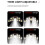 Portable Flashlight 11led Headlamp Outdoor Headset Flashlight USB Charging Long Life Led Multi-function Durable Torch Bright 5