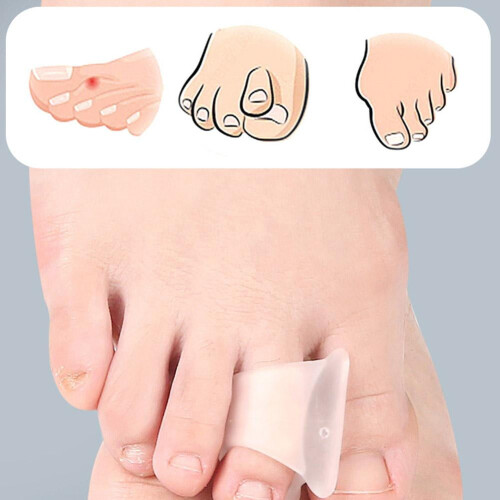 Toe Bending Orthotics, Hammer Shaped Toe Straightener, Cover., Split Toe C3R4 2