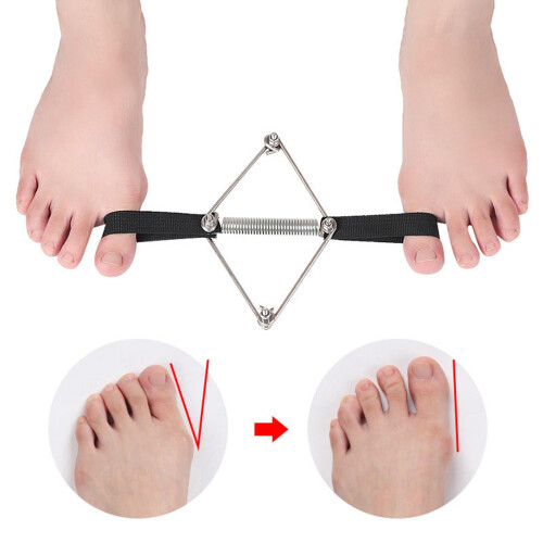 Hallux valgus-korrigerer elastisk nylonstålseparator for store hammertær 2
