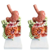 2X Model van Het Menselijk Spijsverteringsstelsel Maaganatomie Dikke Darm Blindedarm Rectum Twaalfvingerige Darm Structuurmodel van Menselijke Interne