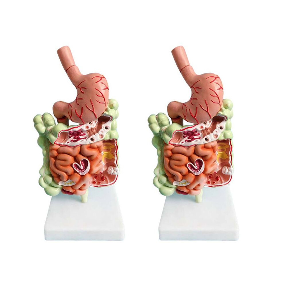 2X Human Digestive System Model Stomach Anatomy Large Intestine Cecum Rectum Duodenum Human Internal Organs
