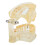 Natural Size Transparent Pathological Teeth Model with Detachable Components, Dental Teaching Model Featuring Root Canals and Dental Implants for 8