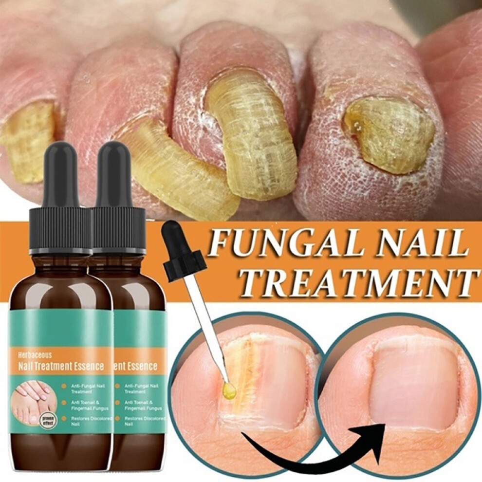 Daily Nail Care Treatment Mild And Safe Formula For Nail Repair, Natural Ingredients Quick Absorption Nail Renewal With Small Applicator